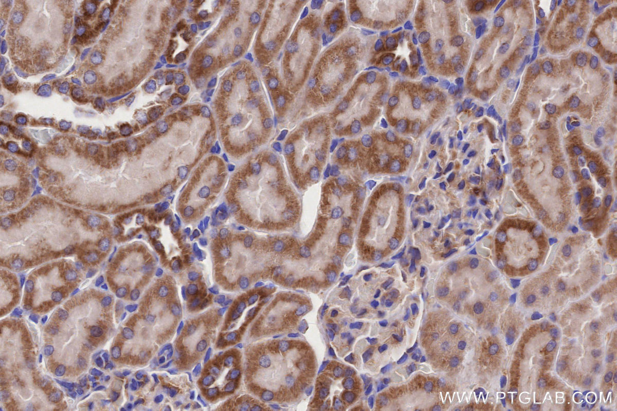 Immunohistochemistry (IHC) staining of rat kidney tissue using MFN1 Monoclonal antibody (66776-1-Ig)