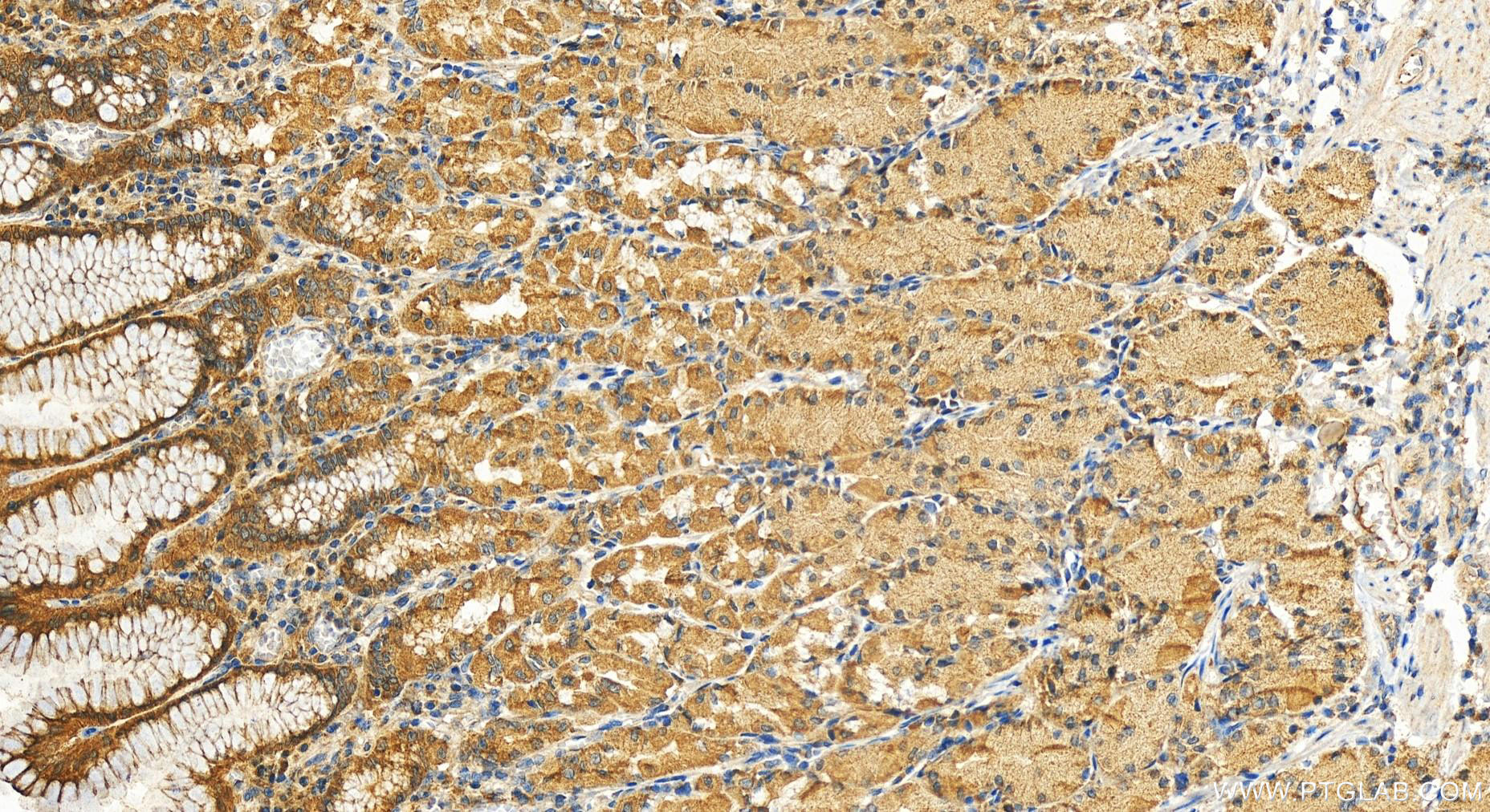 Immunohistochemistry (IHC) staining of human stomach tissue using MFSD10 Polyclonal antibody (11518-1-AP)