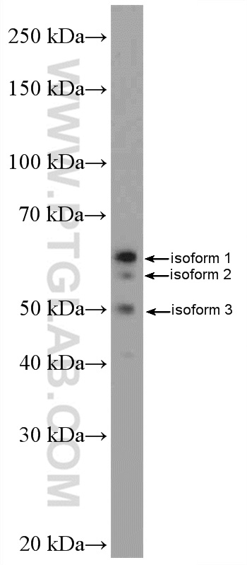 MFSD2 antibody (25498-1-AP) | Proteintech