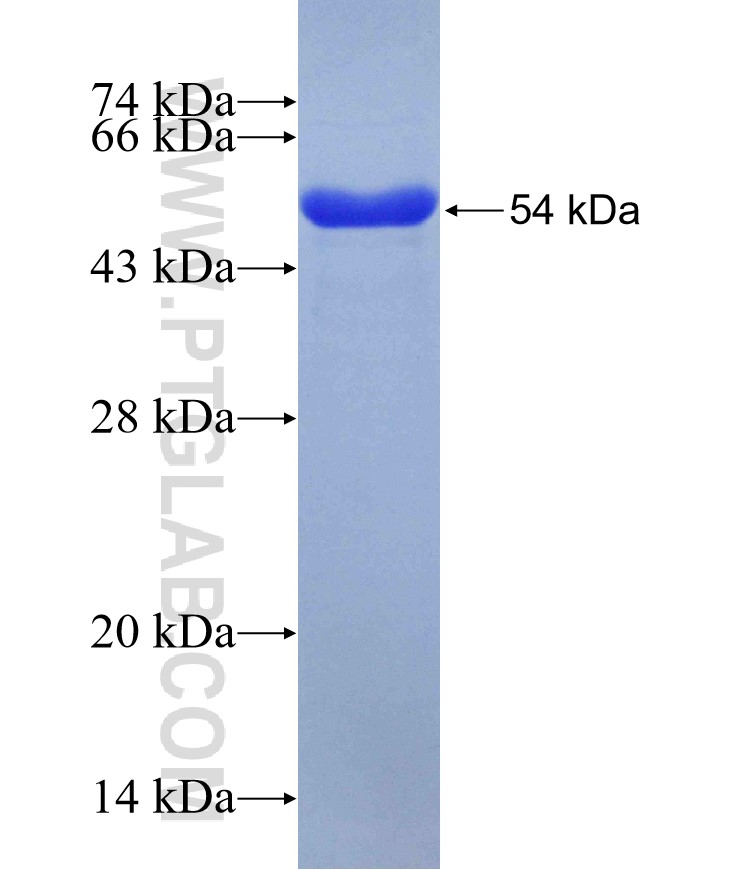 MGA fusion protein Ag30021 SDS-PAGE