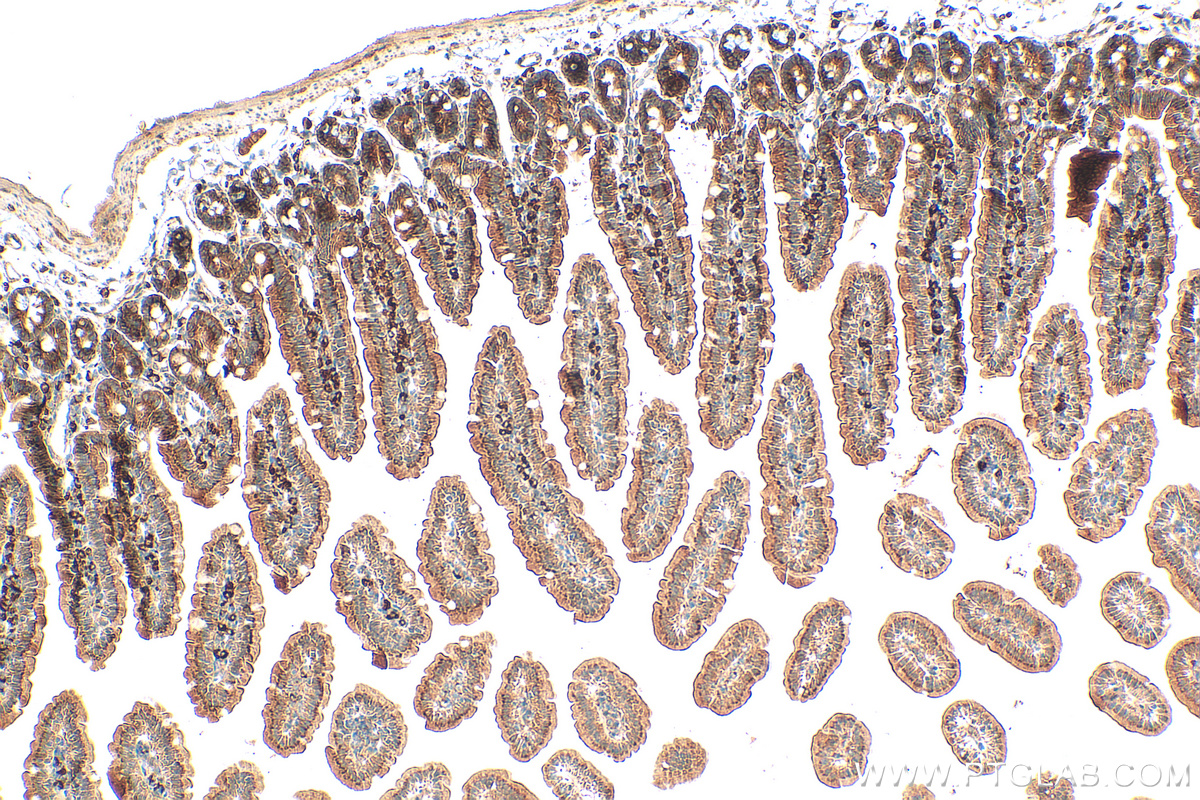 Immunohistochemistry (IHC) staining of mouse small intestine tissue using MGAT4A Polyclonal antibody (25109-1-AP)