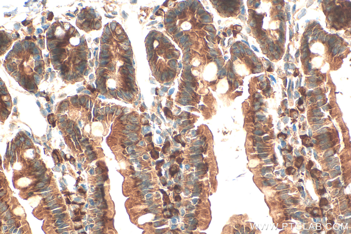 Immunohistochemistry (IHC) staining of mouse small intestine tissue using MGAT4A Polyclonal antibody (25109-1-AP)