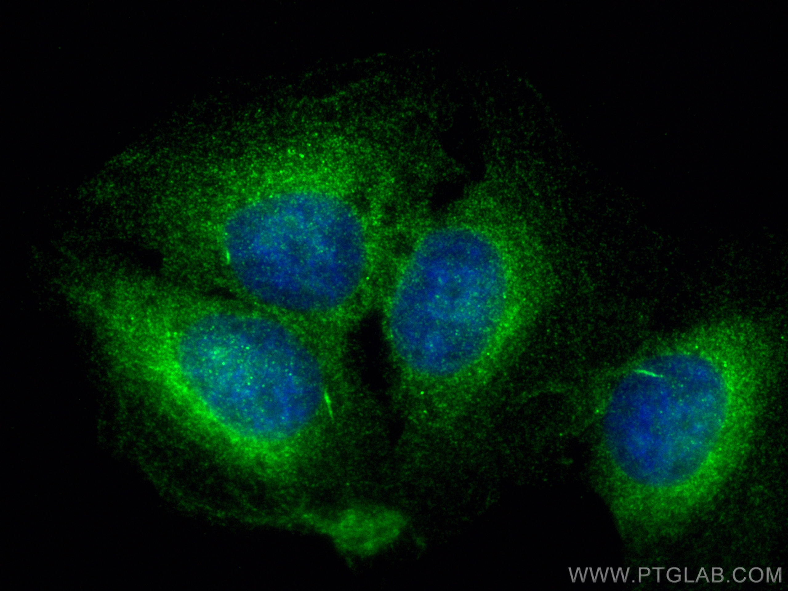 Immunofluorescence (IF) / fluorescent staining of U2OS cells using MGAT4B Polyclonal antibody (30718-1-AP)