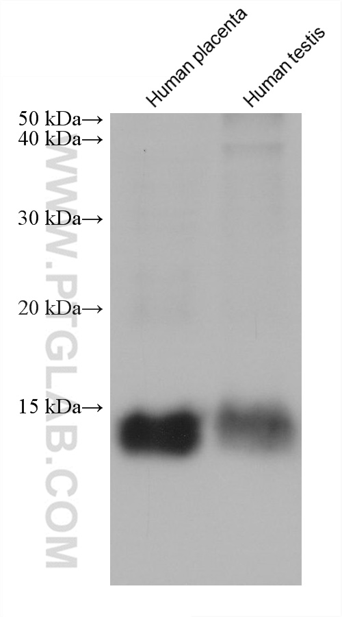 Western Blot (WB) analysis of various lysates using MGP Monoclonal antibody (60055-1-Ig)