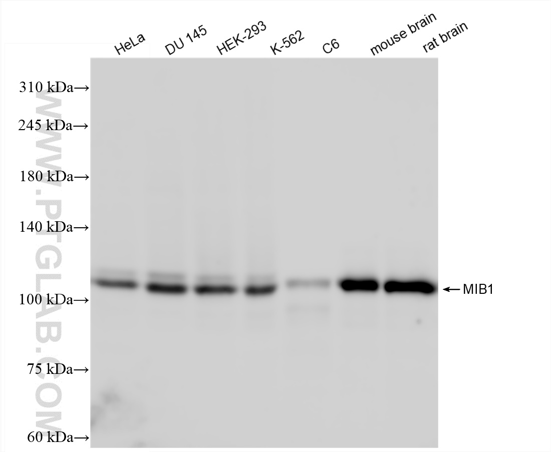 Western Blot (WB) analysis of various lysates using MIB1 Recombinant antibody (83718-5-RR)