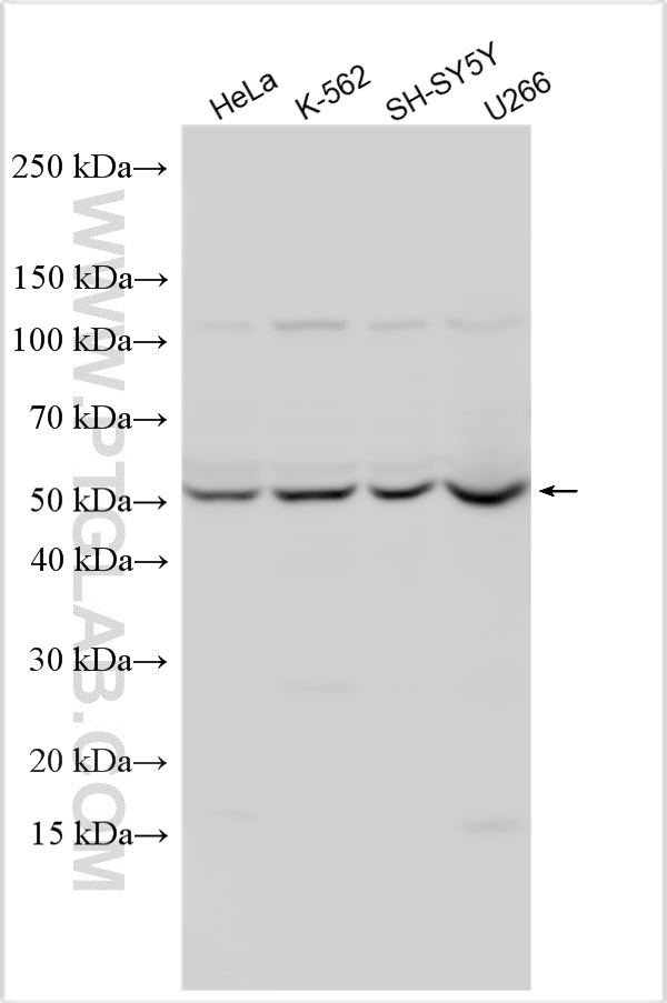 Western Blot (WB) analysis of various lysates using MICA Polyclonal antibody (12619-1-AP)