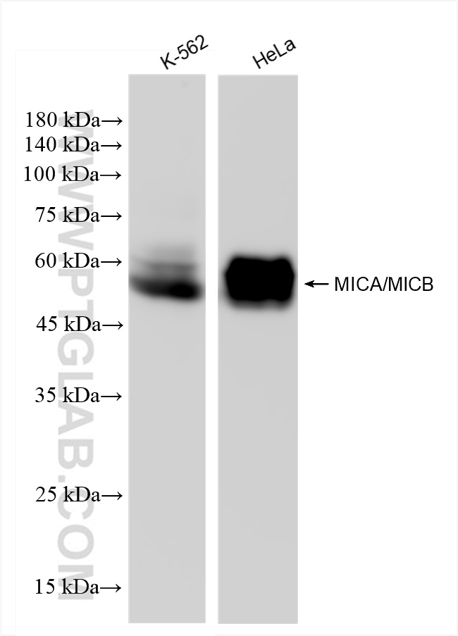 Western Blot (WB) analysis of various lysates using MICA/MICB Recombinant antibody (83725-5-RR)