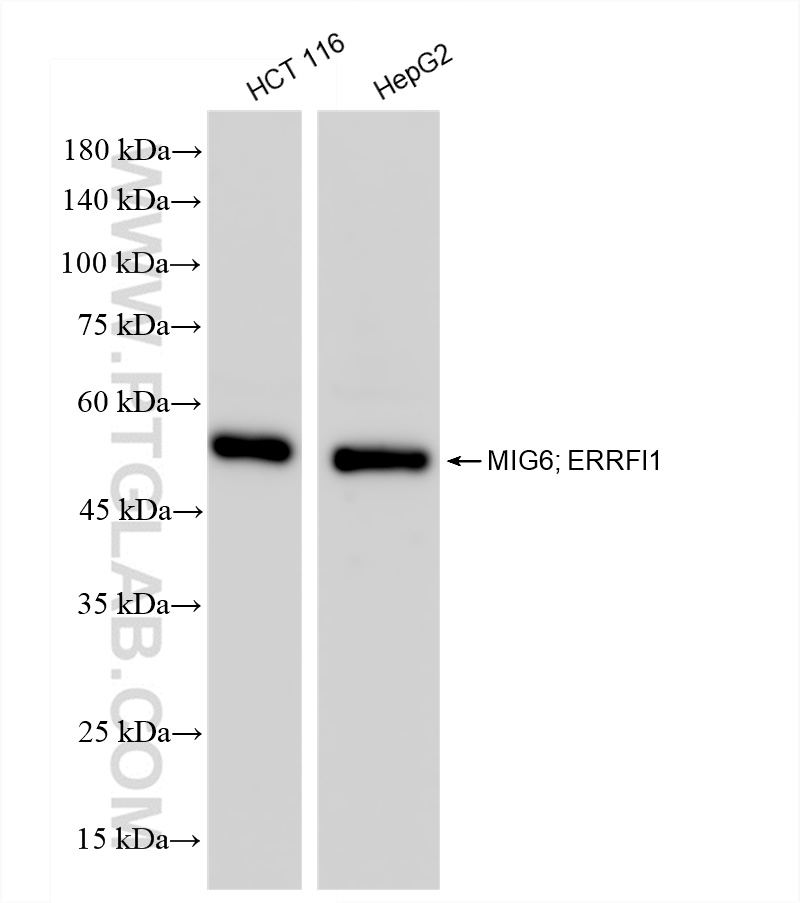 Western Blot (WB) analysis of various lysates using MIG6; ERRFI1 Recombinant antibody (83475-2-RR)