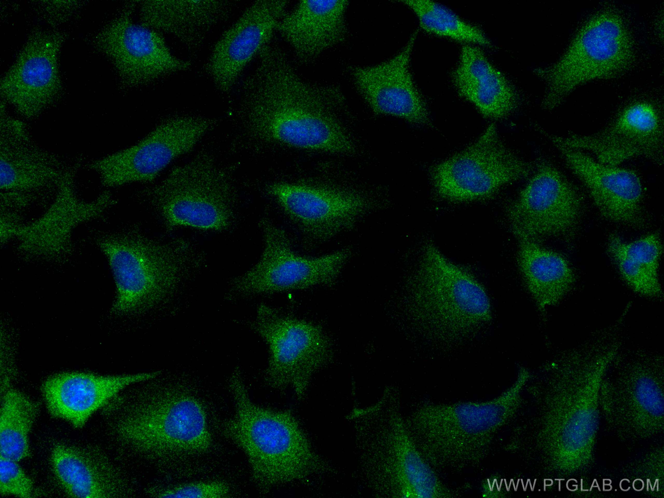 Immunofluorescence (IF) / fluorescent staining of A549 cells using MITD1 Polyclonal antibody (17264-1-AP)