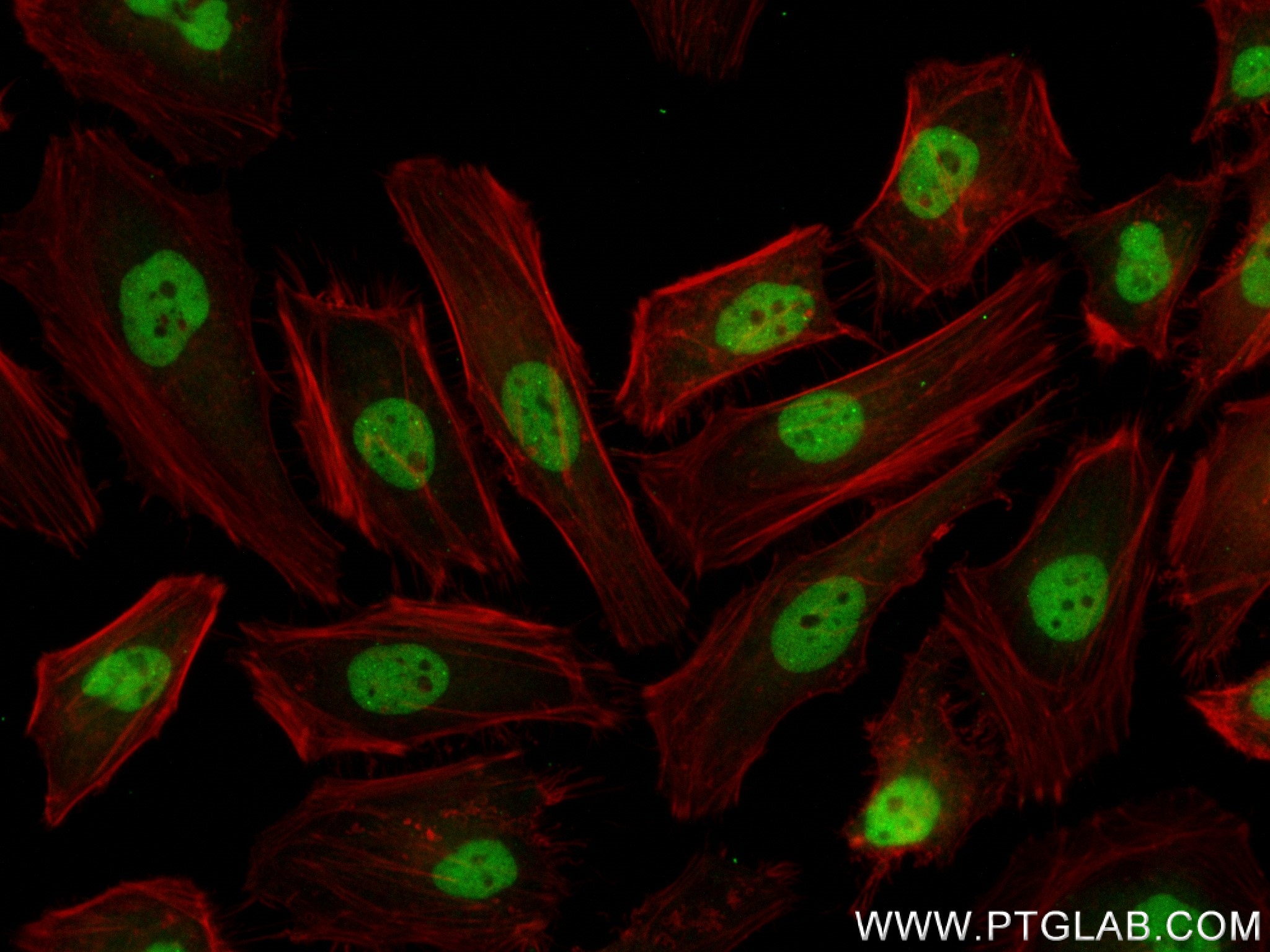 Immunofluorescence (IF) / fluorescent staining of HeLa cells using MITF Recombinant antibody (83803-2-RR)