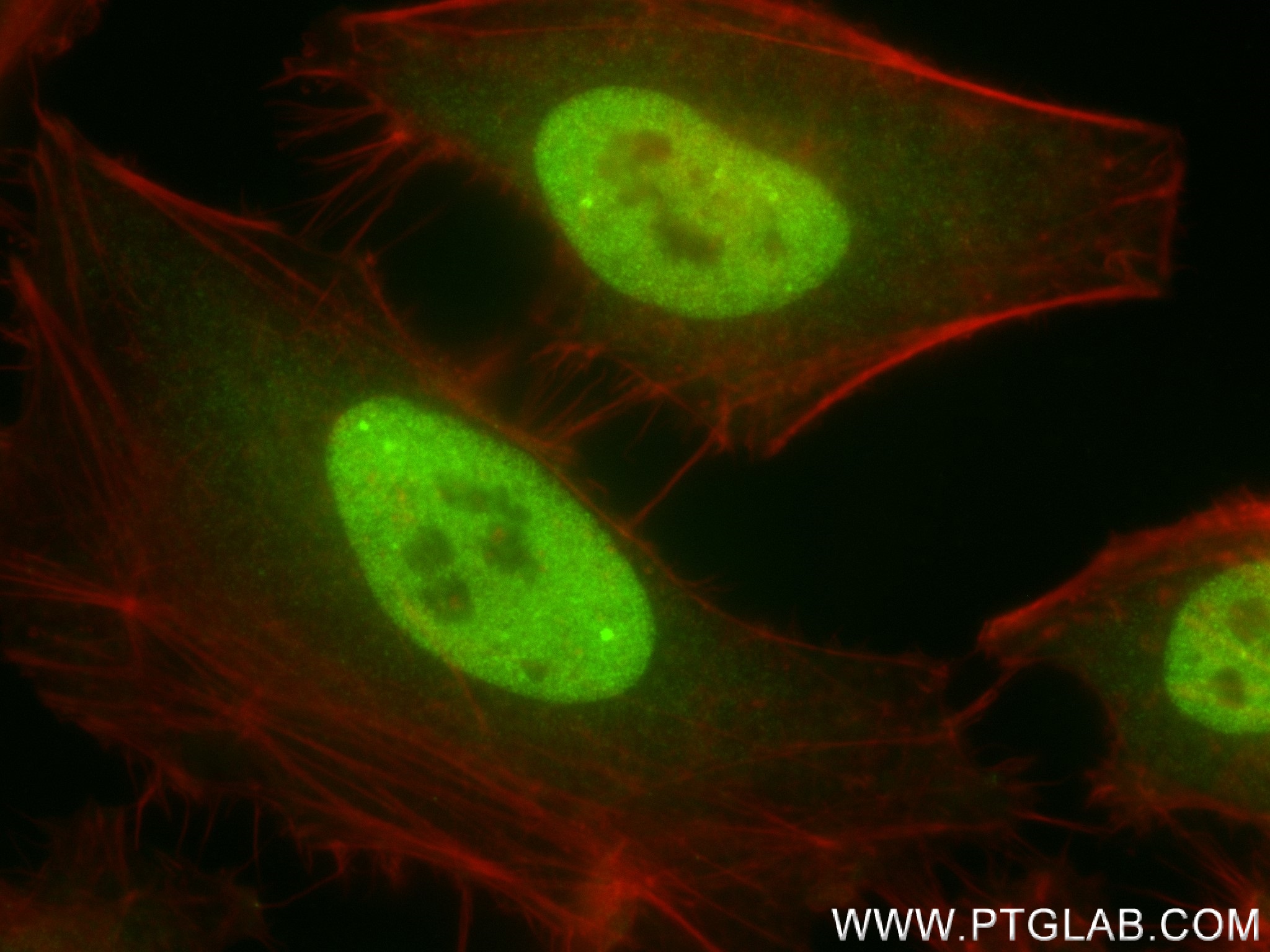 Immunofluorescence (IF) / fluorescent staining of HeLa cells using MITF Recombinant antibody (83803-2-RR)