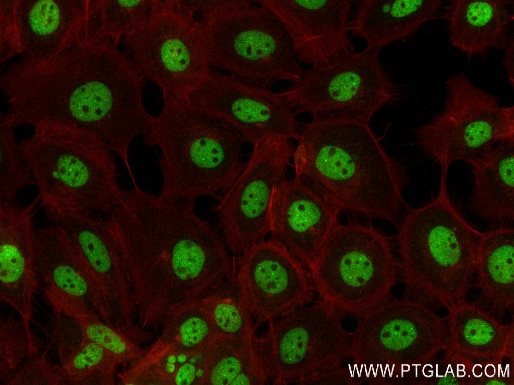 Immunofluorescence (IF) / fluorescent staining of A431 cells using MITF Recombinant antibody (83803-2-RR)