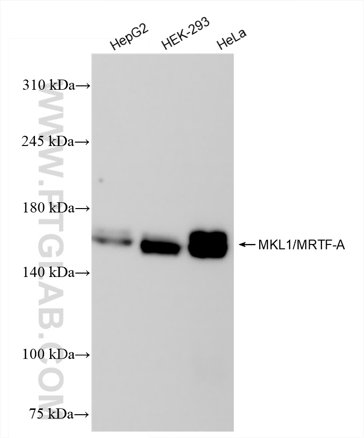 Western Blot (WB) analysis of various lysates using MKL1/MRTF-A Recombinant antibody (84903-1-RR)