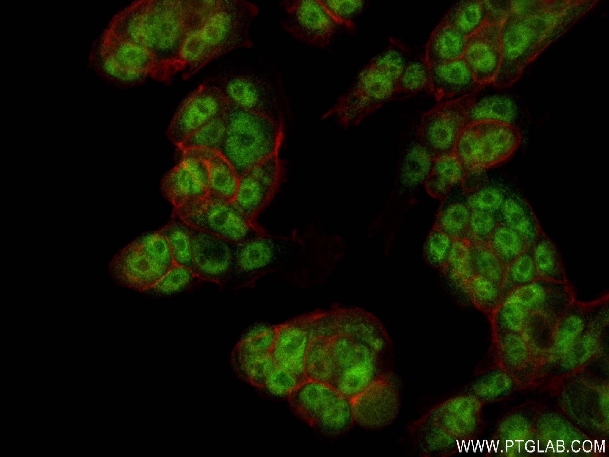 Immunofluorescence (IF) / fluorescent staining of MCF-7 cells using MKNK2 Recombinant antibody (83235-1-RR)