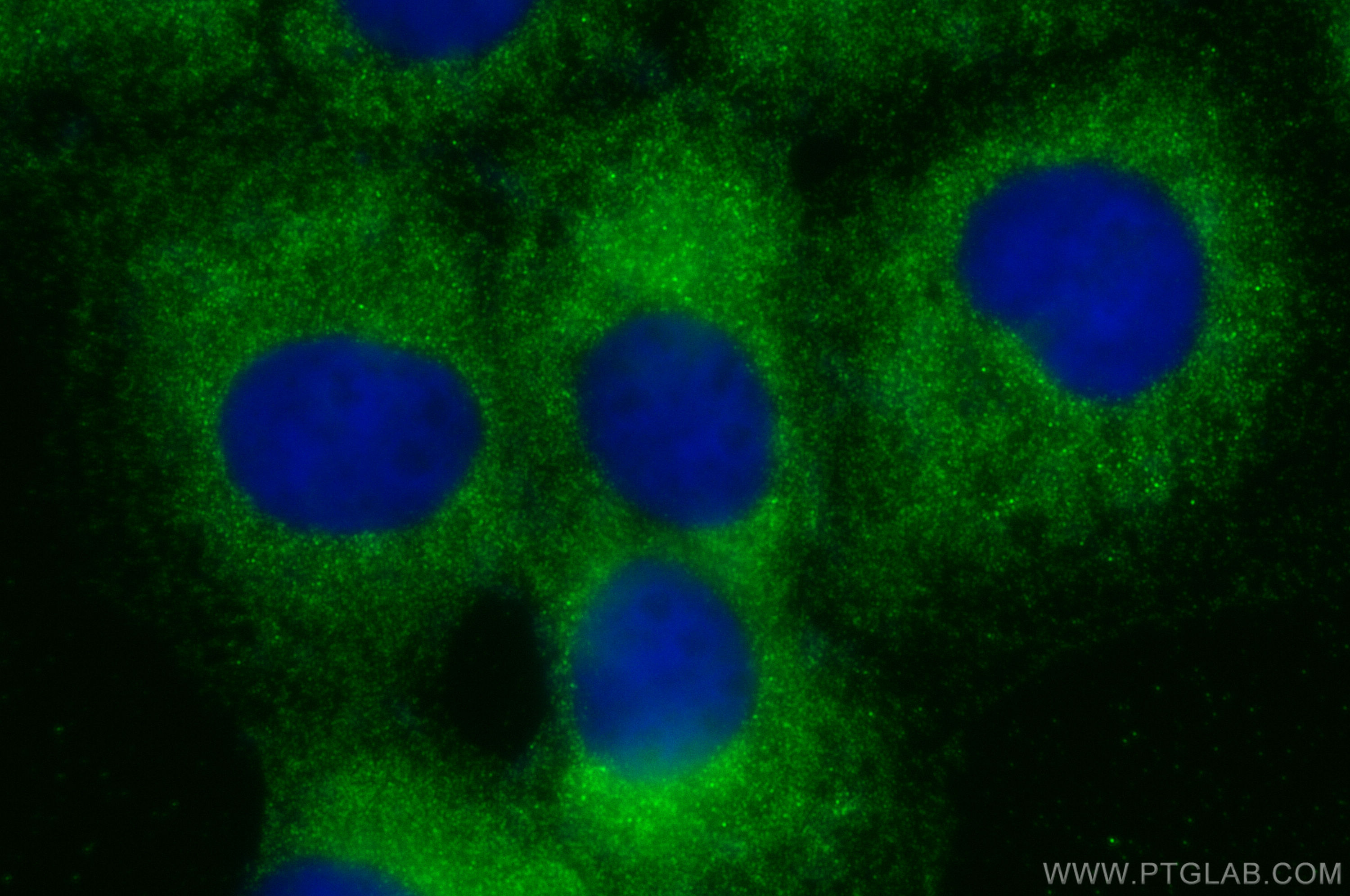 Immunofluorescence (IF) / fluorescent staining of A431 cells using MKRN3 Polyclonal antibody (18349-1-AP)