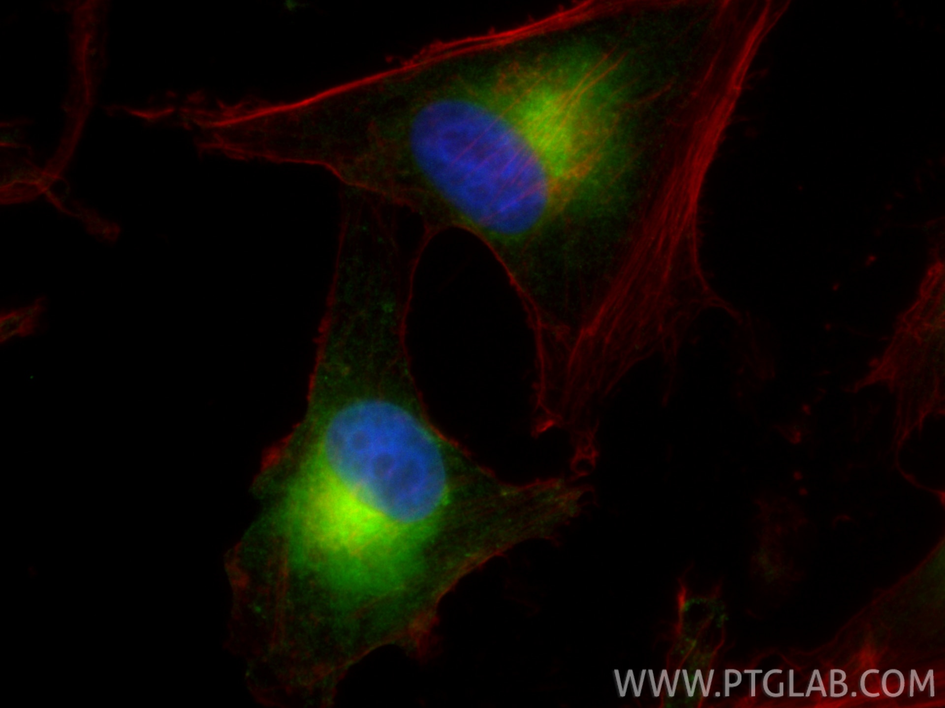 Immunofluorescence (IF) / fluorescent staining of SK-MEL-28 cells using Melan-A Polyclonal antibody (18472-1-AP)