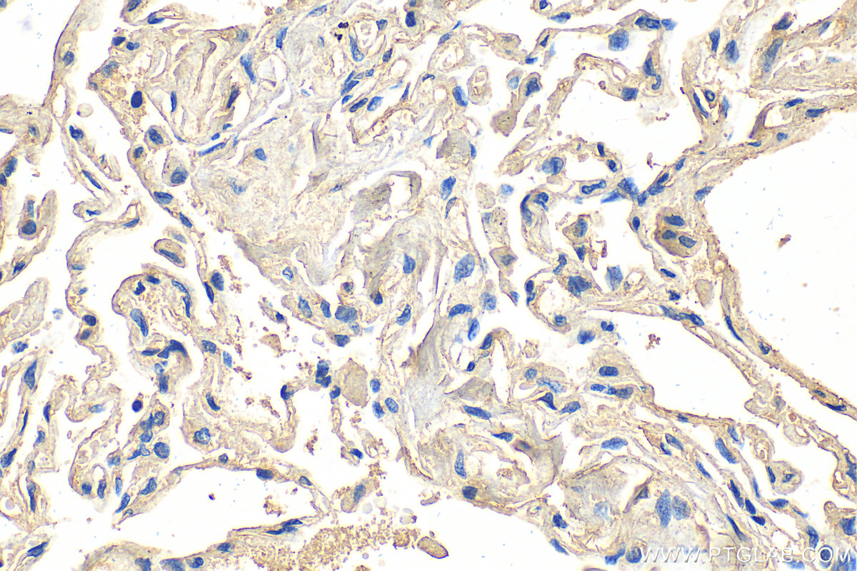 Immunohistochemistry (IHC) staining of human lung tissue using Melan-A  Monoclonal antibody (60348-1-Ig)