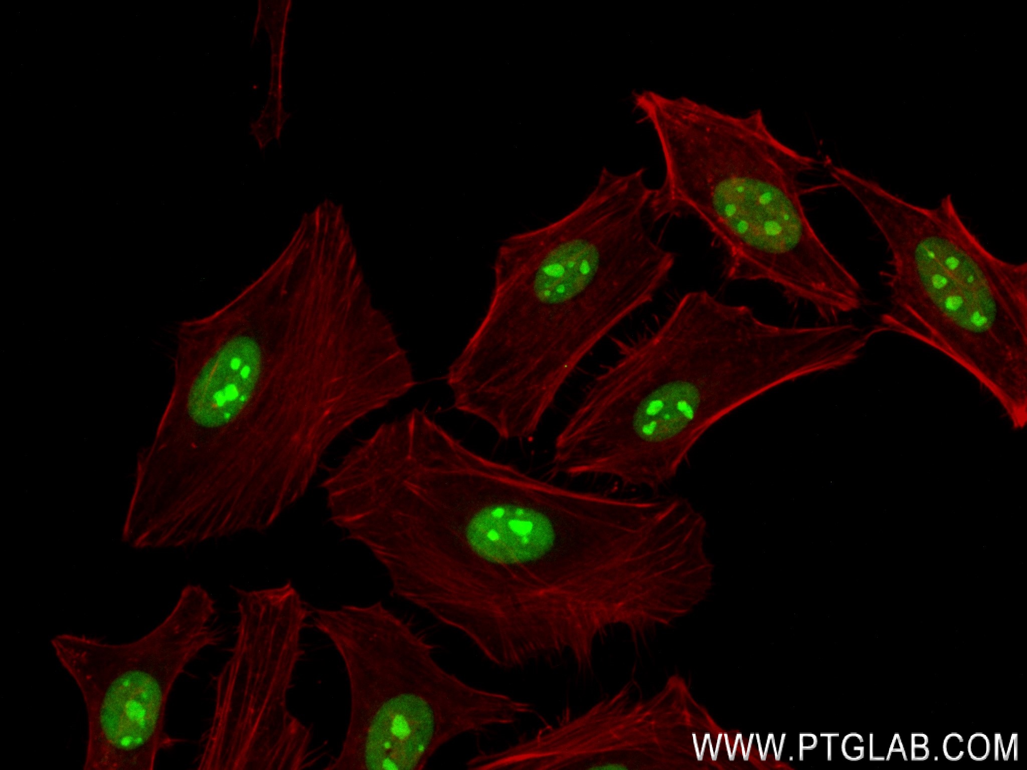 Immunofluorescence (IF) / fluorescent staining of HeLa cells using MLH1 Recombinant antibody (84208-2-RR)