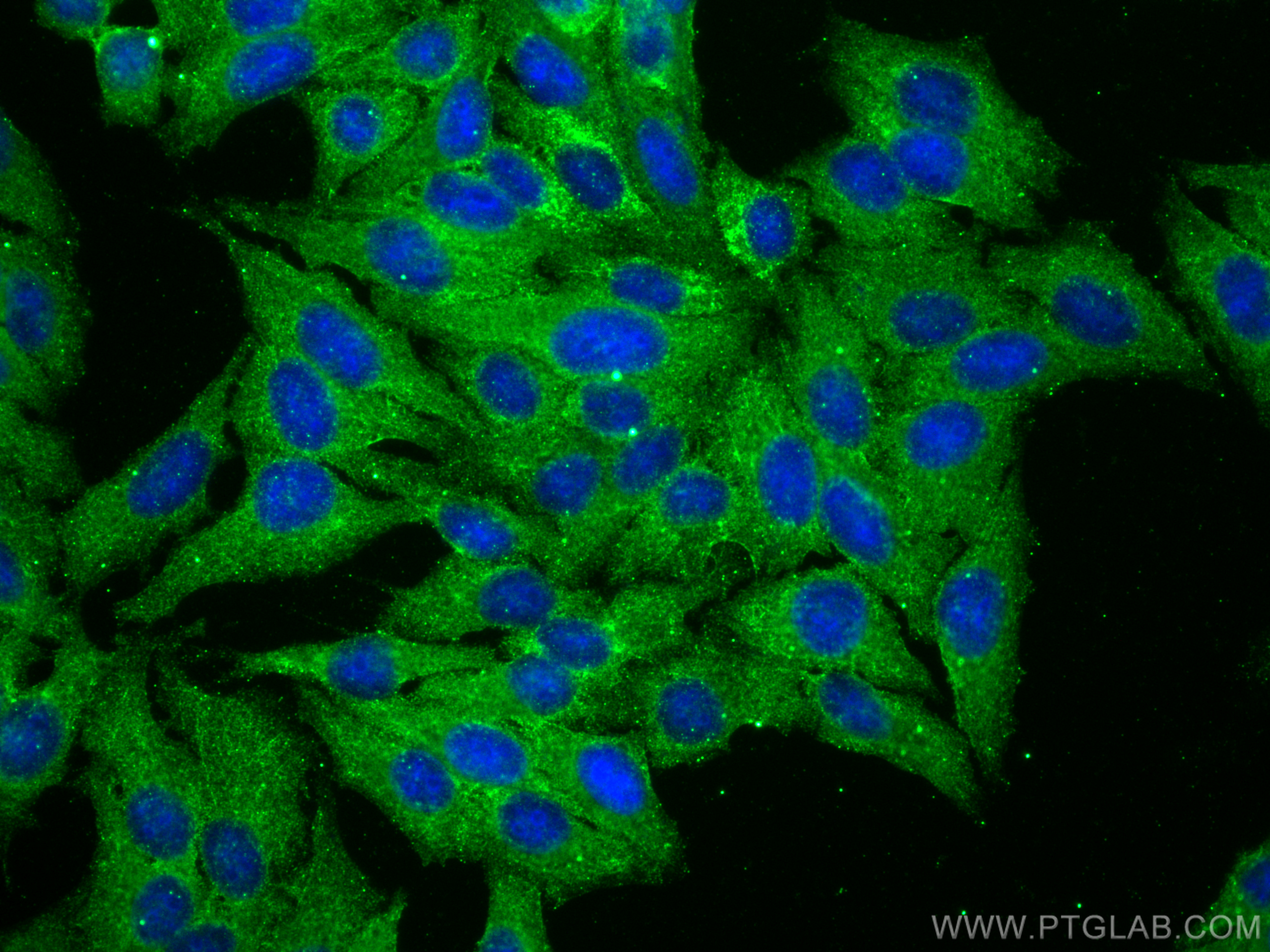 Immunofluorescence (IF) / fluorescent staining of HepG2 cells using MLKL Monoclonal antibody (66675-1-Ig)