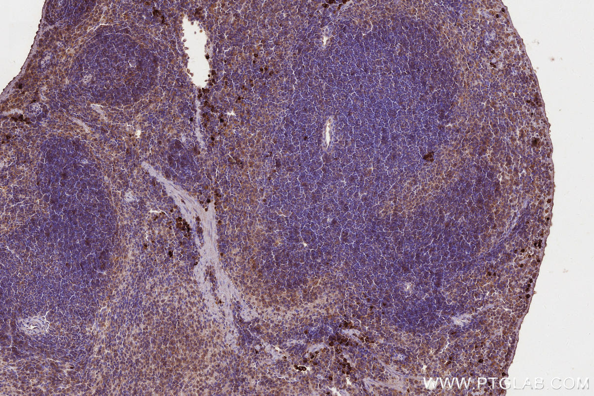 Immunohistochemistry (IHC) staining of mouse spleen tissue using MLKL Monoclonal antibody (66675-1-Ig)