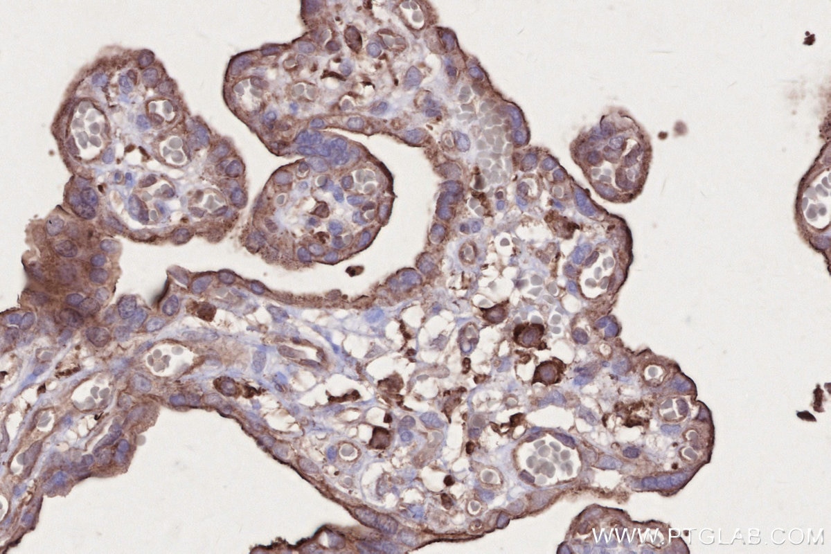 Immunohistochemistry (IHC) staining of human placenta tissue using MLKL Monoclonal antibody (66675-1-Ig)