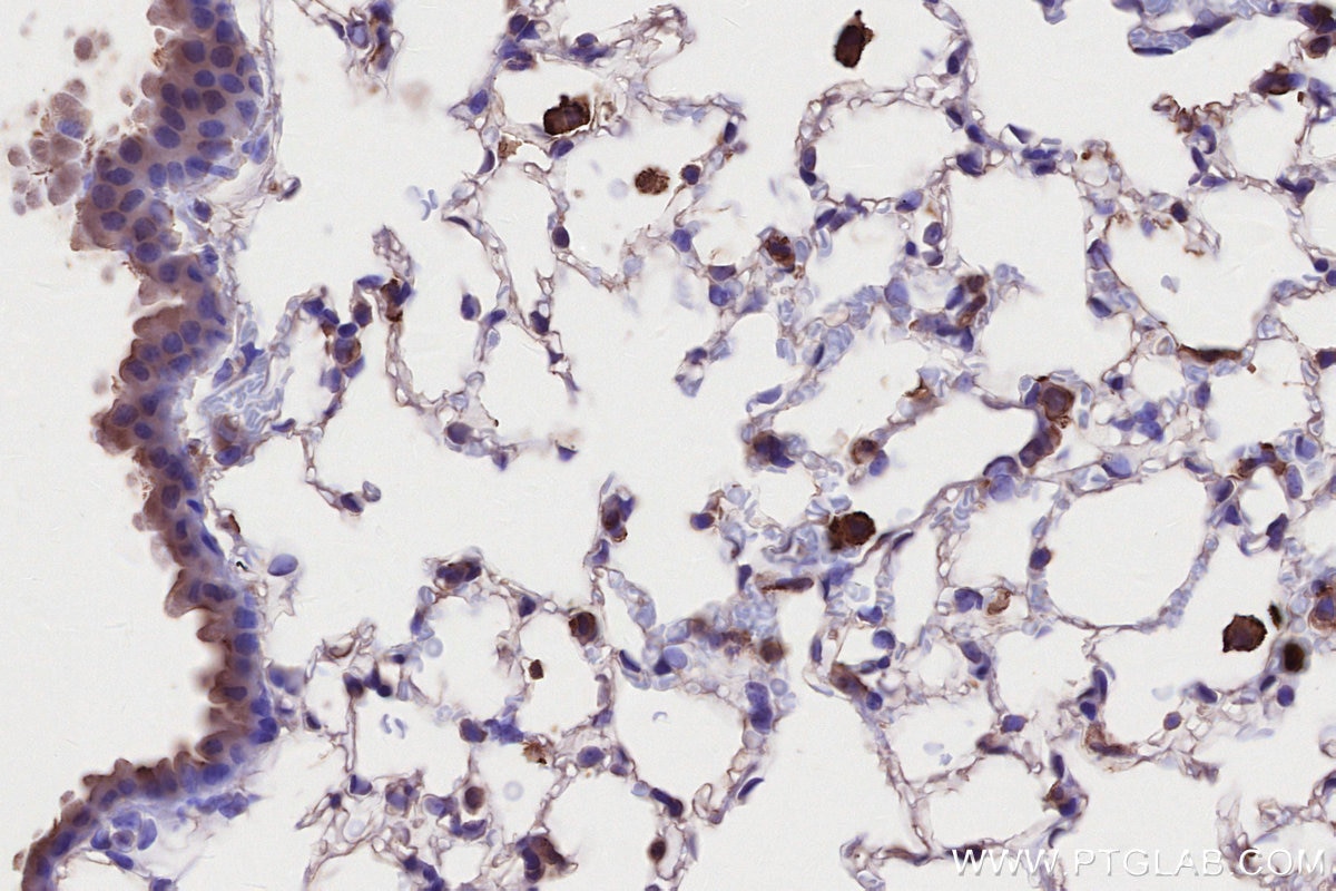 Immunohistochemistry (IHC) staining of mouse lung tissue using MLKL Monoclonal antibody (66675-1-Ig)