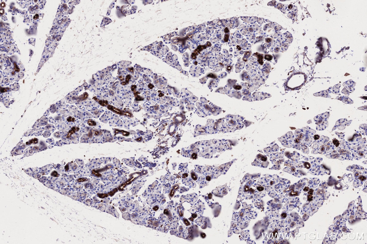 Immunohistochemistry (IHC) staining of mouse salivary gland tissue using MLKL Monoclonal antibody (66675-1-Ig)