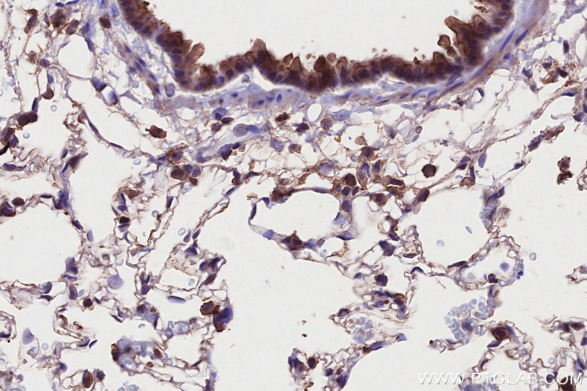 Immunohistochemistry (IHC) staining of rat lung tissue using MLKL Monoclonal antibody (66675-1-Ig)
