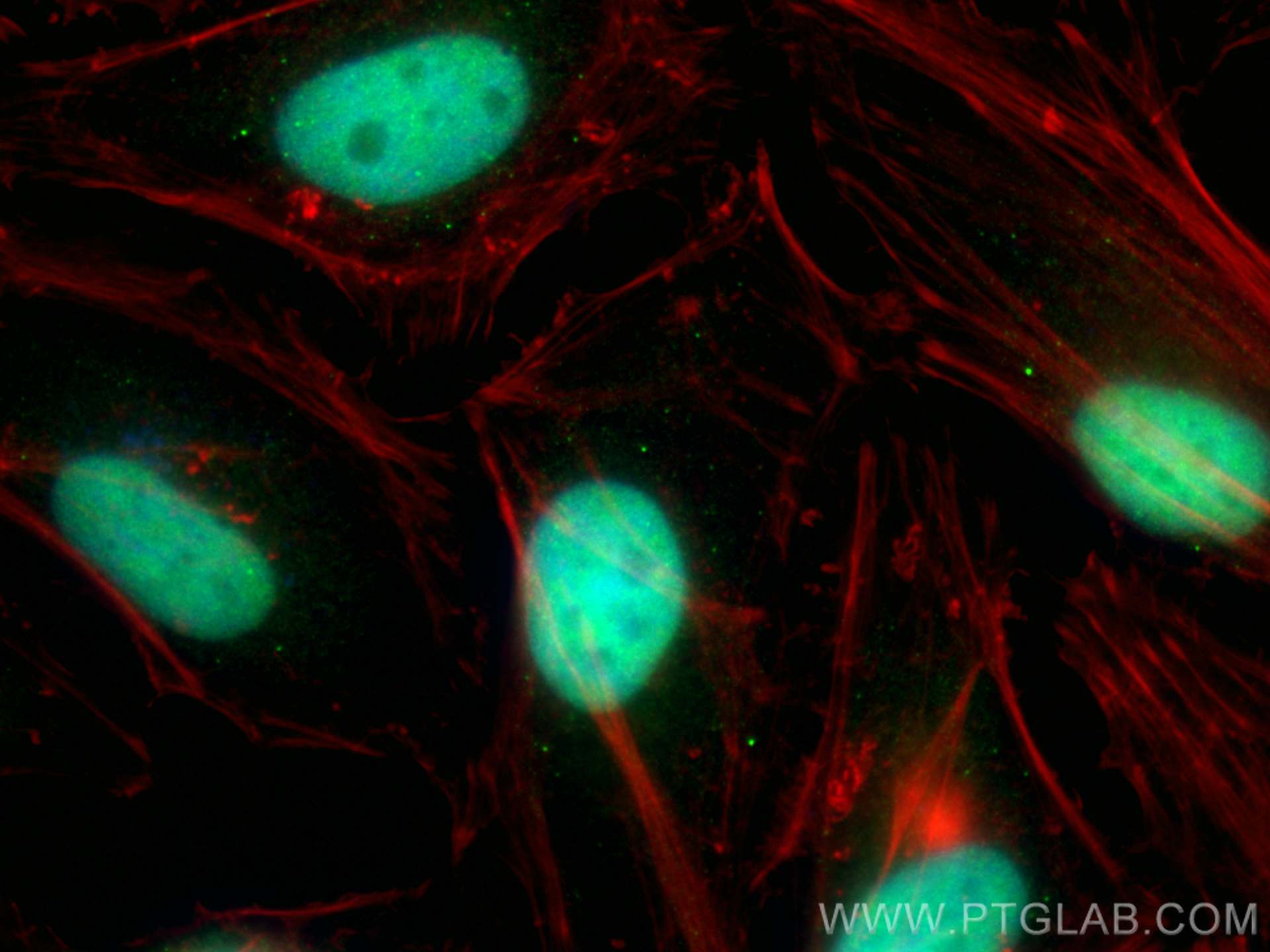 Immunofluorescence (IF) / fluorescent staining of HeLa cells using MLLT1 Polyclonal antibody (31029-1-AP)