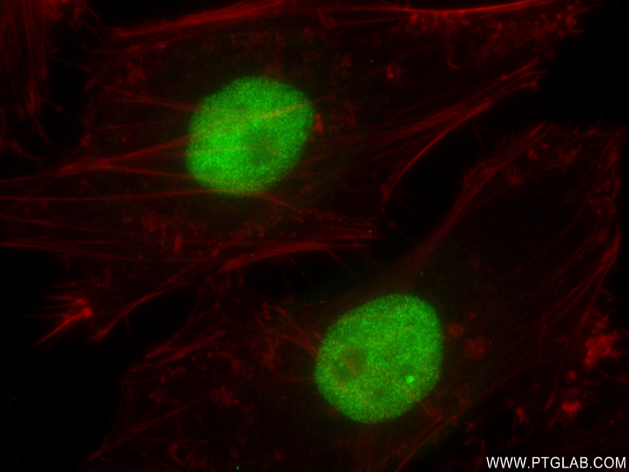 Immunofluorescence (IF) / fluorescent staining of HeLa cells using MLLT1 Recombinant antibody (83242-3-RR)