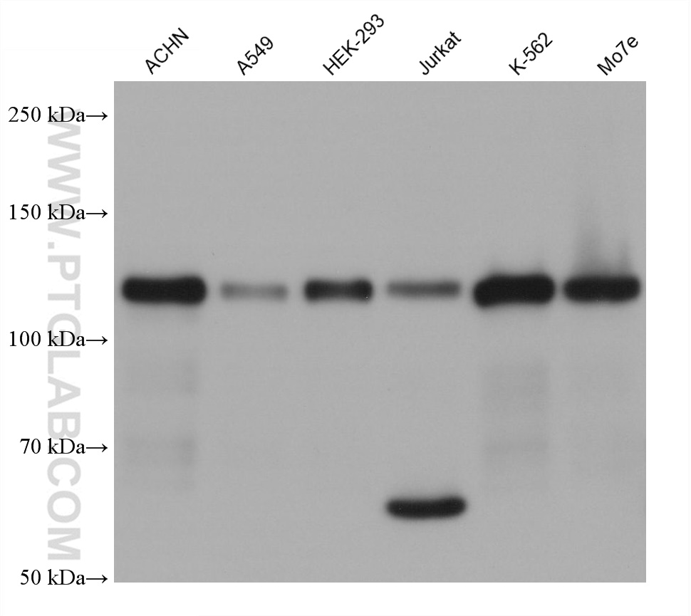 Western Blot (WB) analysis of various lysates using MLXIP Monoclonal antibody (68977-1-Ig)