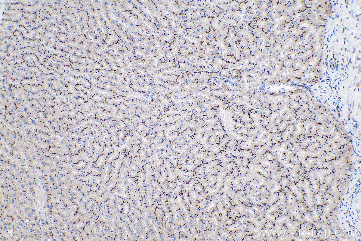 Immunohistochemistry (IHC) staining of human liver tissue using MME,CD10 Monoclonal antibody (60034-3-Ig)