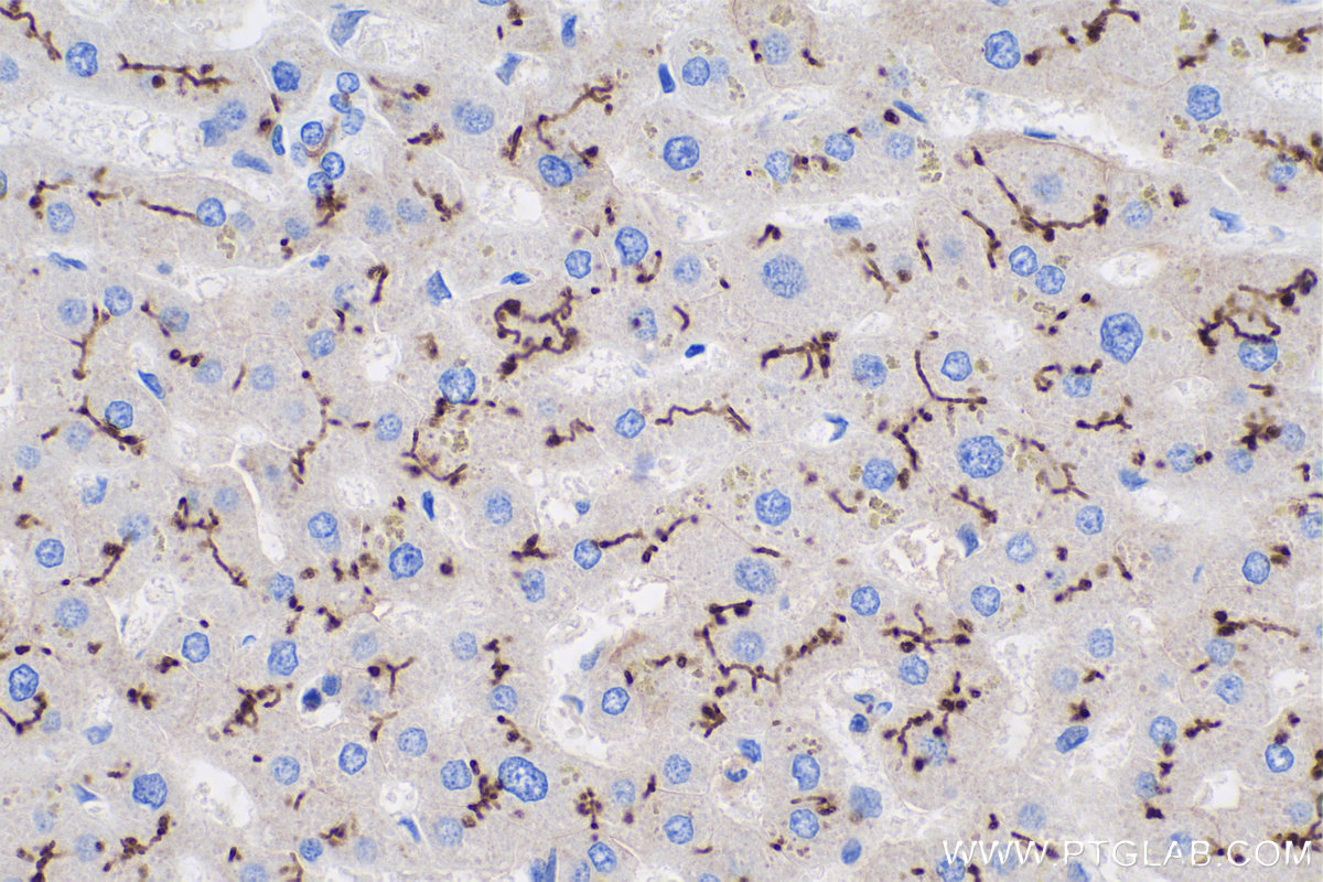 Immunohistochemistry (IHC) staining of human liver tissue using MME,CD10 Monoclonal antibody (60034-3-Ig)