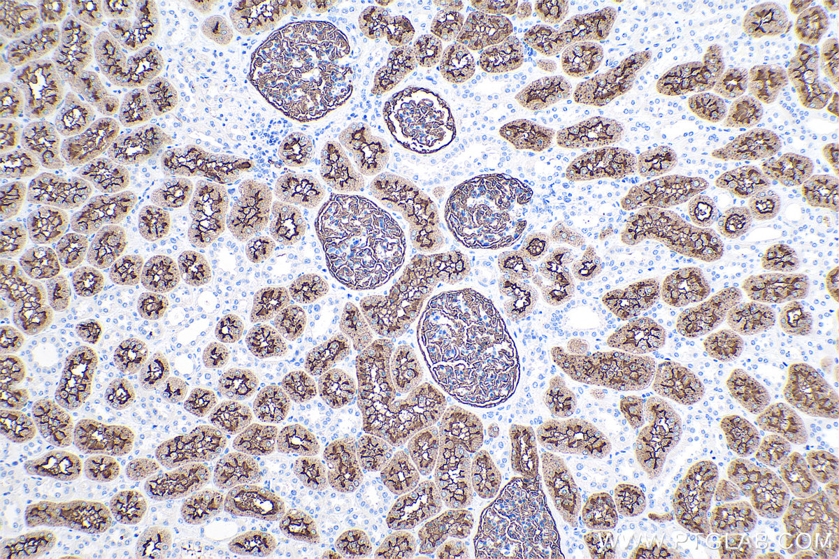 Immunohistochemistry (IHC) staining of human kidney tissue using MME,CD10 Monoclonal antibody (60034-3-Ig)