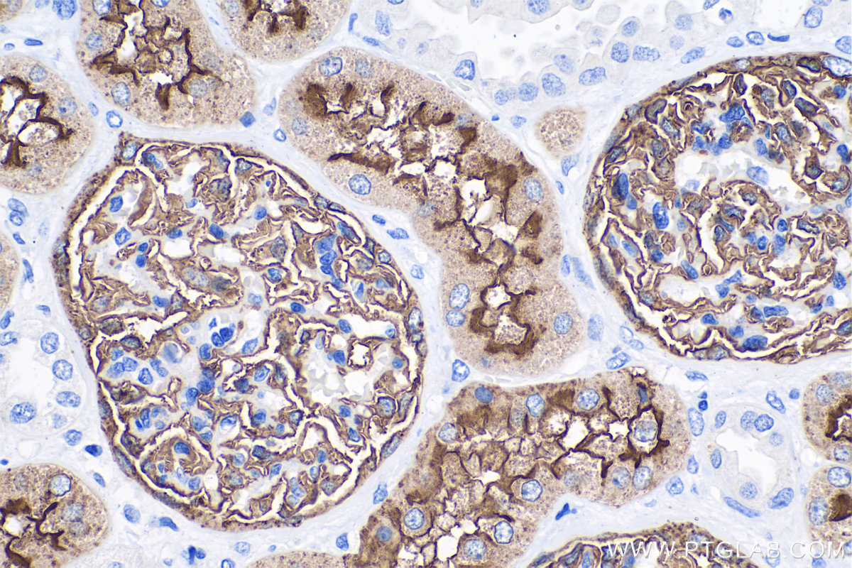 Immunohistochemistry (IHC) staining of human kidney tissue using MME,CD10 Monoclonal antibody (60034-3-Ig)