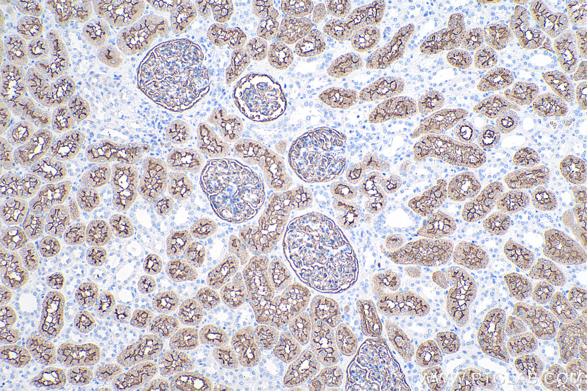 Immunohistochemistry (IHC) staining of human kidney tissue using MME,CD10 Monoclonal antibody (60034-3-Ig)