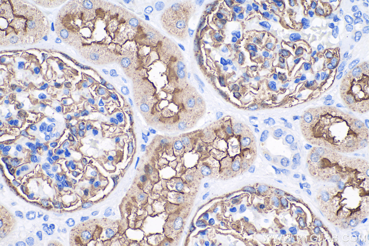 Immunohistochemistry (IHC) staining of human kidney tissue using MME,CD10 Monoclonal antibody (60034-3-Ig)