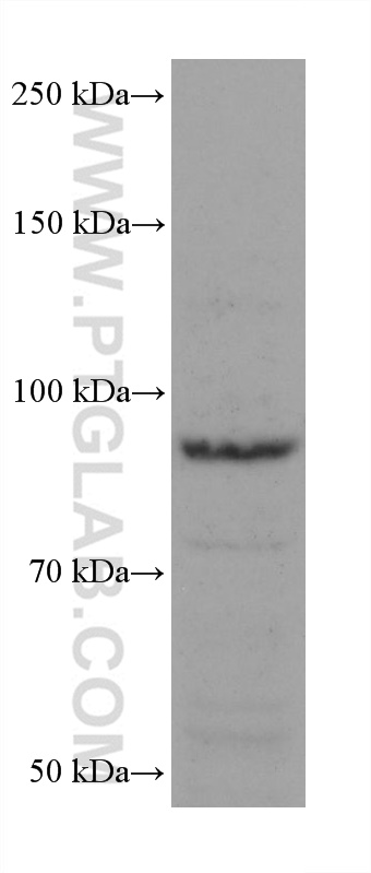 Western Blot (WB) analysis of Daudi cells using Neprilysin/CD10 Monoclonal antibody (60034-3-Ig)