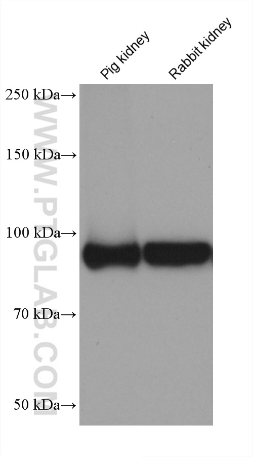 Western Blot (WB) analysis of various lysates using Neprilysin/CD10 Monoclonal antibody (60034-3-Ig)