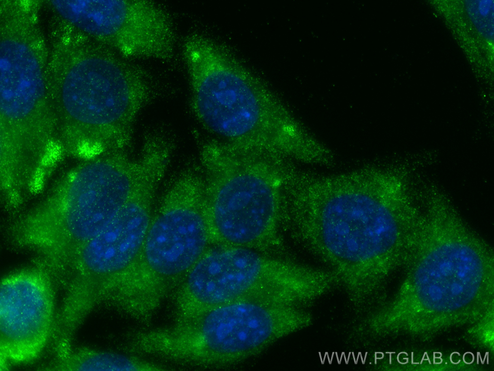 Immunofluorescence (IF) / fluorescent staining of HepG2 cells using MMP1 Polyclonal antibody (30805-1-AP)