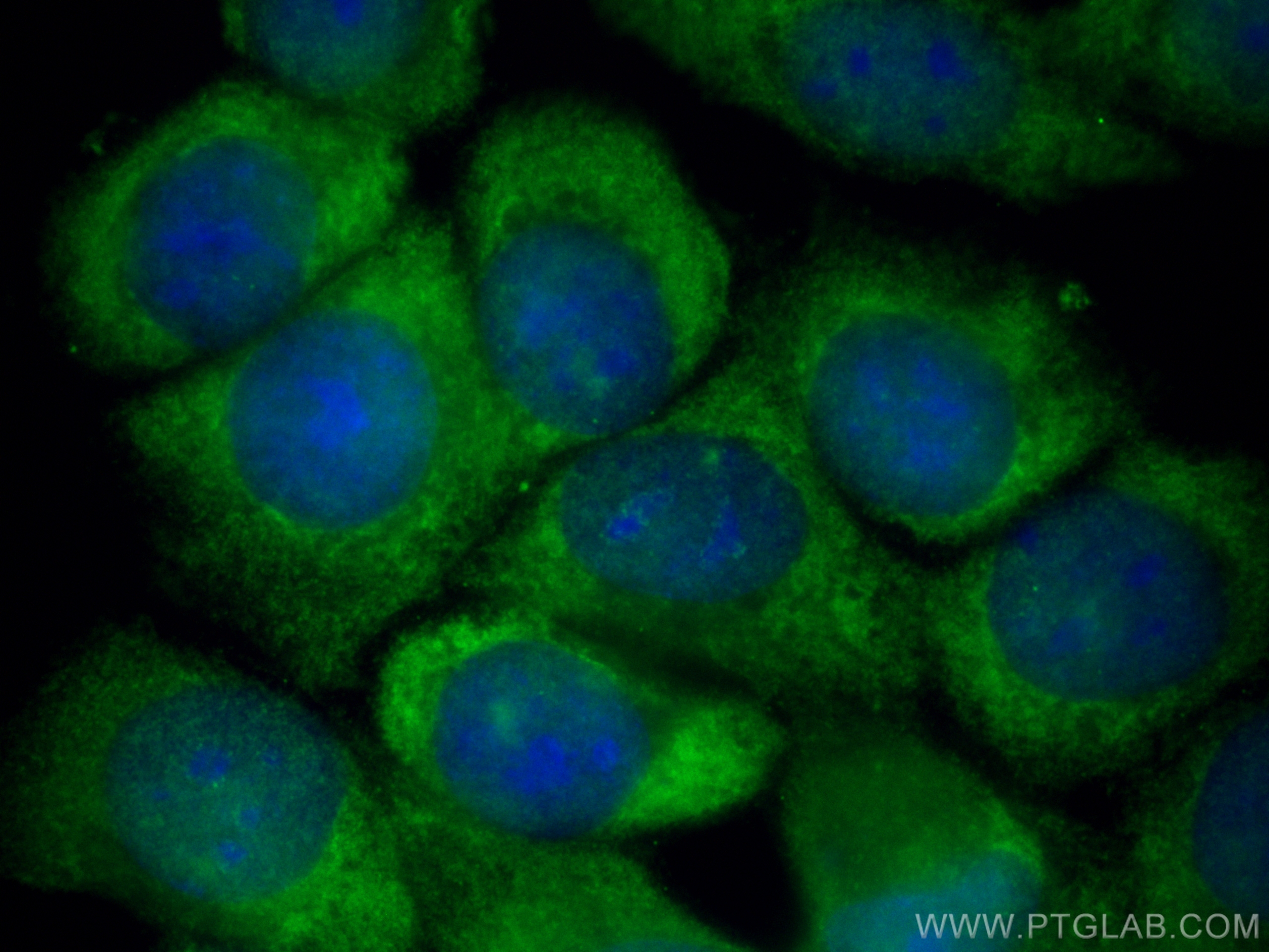 Immunofluorescence (IF) / fluorescent staining of MCF-7 cells using CoraLite® Plus 488-conjugated MMP1 Recombinant ant (CL488-83114-2)