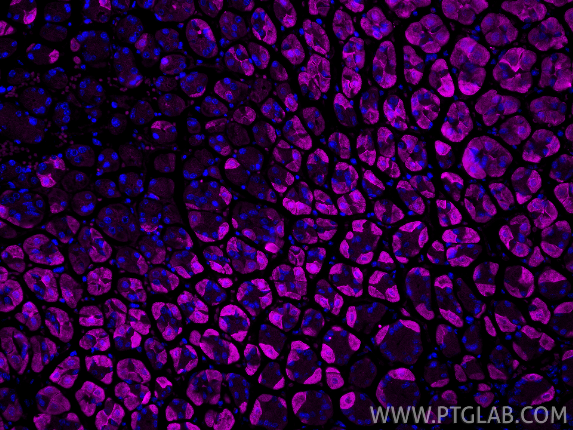 Immunofluorescence (IF) / fluorescent staining of mouse stomach tissue using CoraLite® Plus 647-conjugated MMP1 Polyclonal anti (CL647-10371)