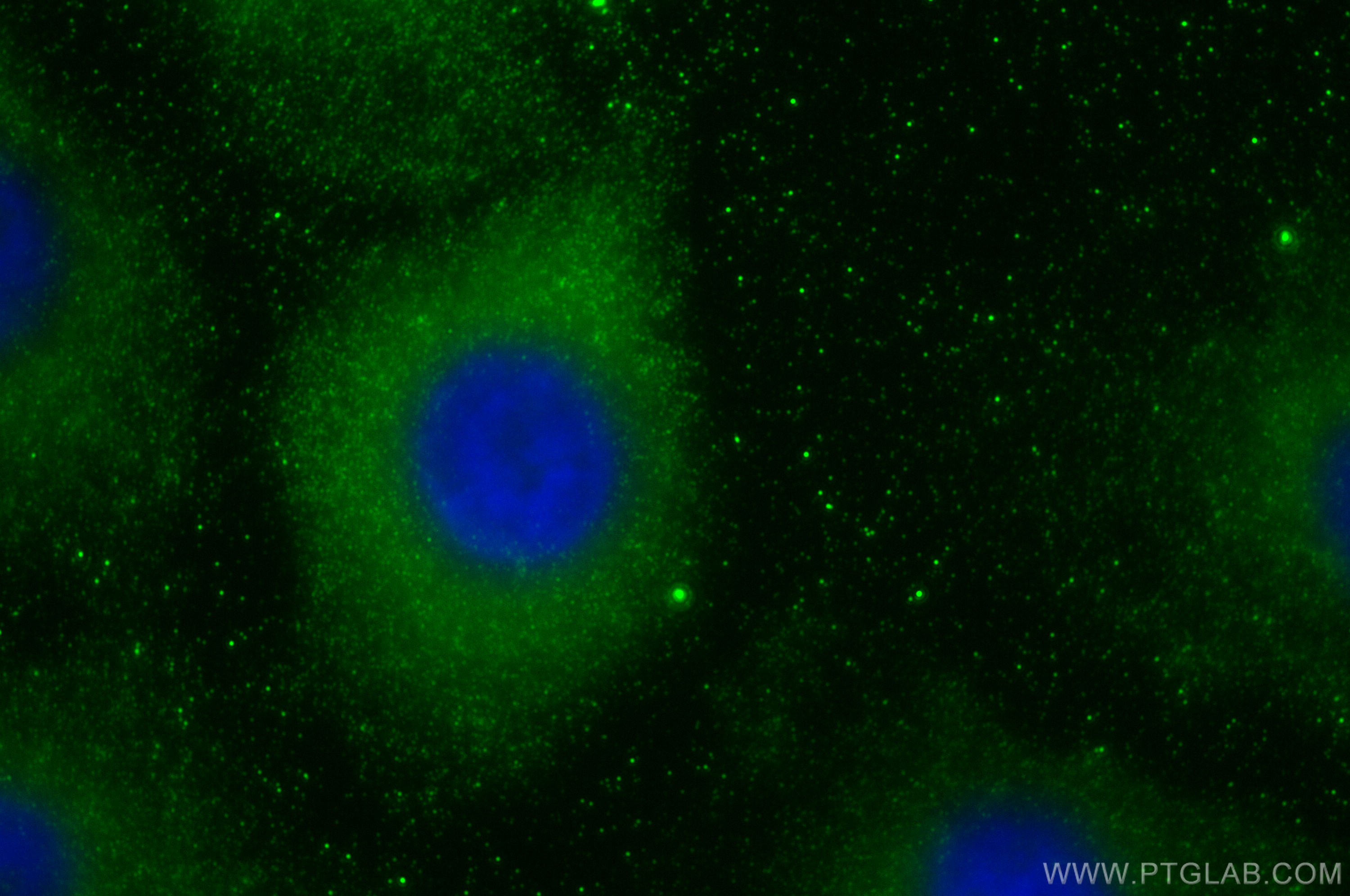 Immunofluorescence (IF) / fluorescent staining of A549 cells using MMP11 Polyclonal antibody (30615-1-AP)