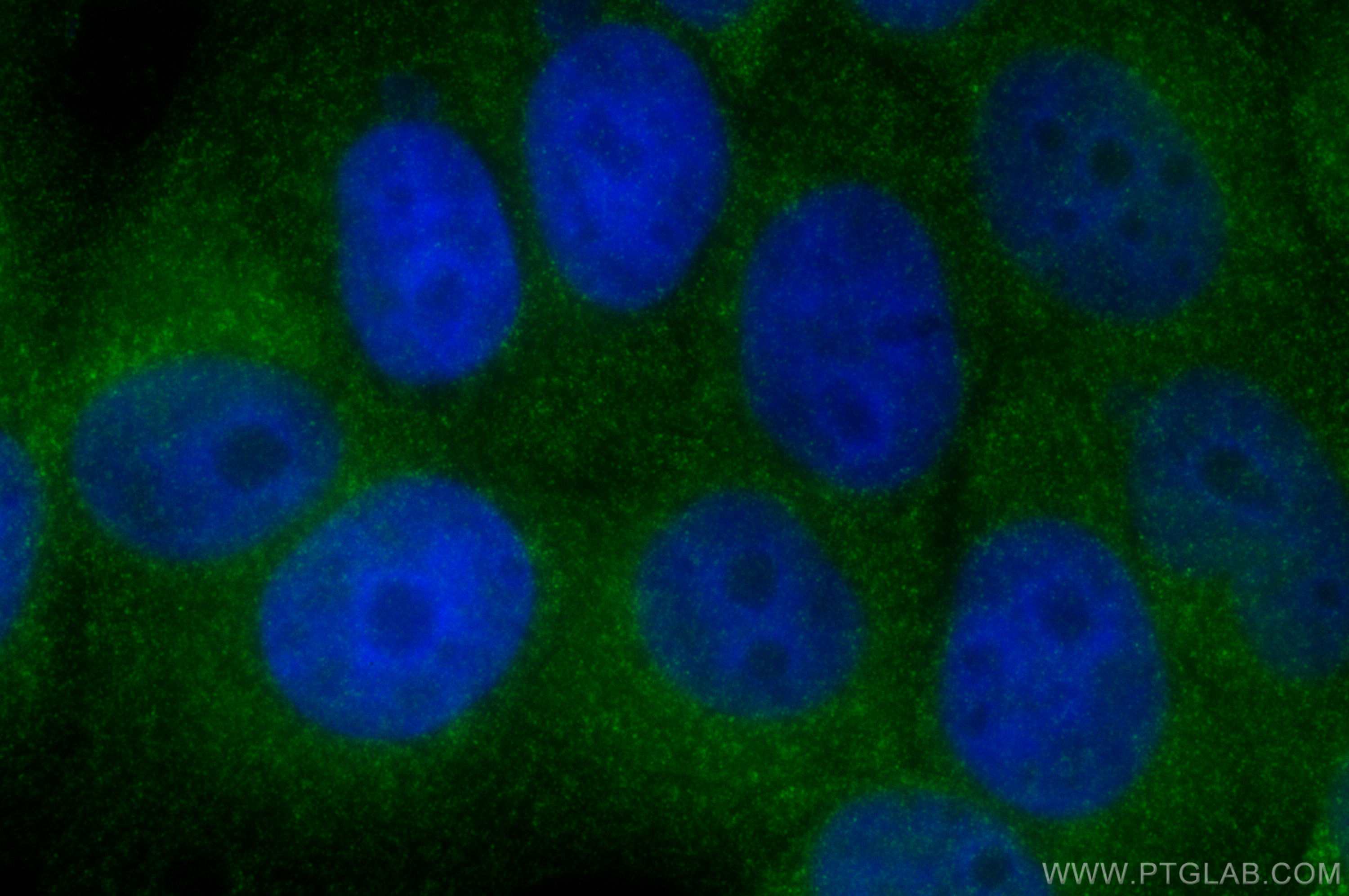 Immunofluorescence (IF) / fluorescent staining of MCF-7 cells using MMP11 Polyclonal antibody (30615-1-AP)