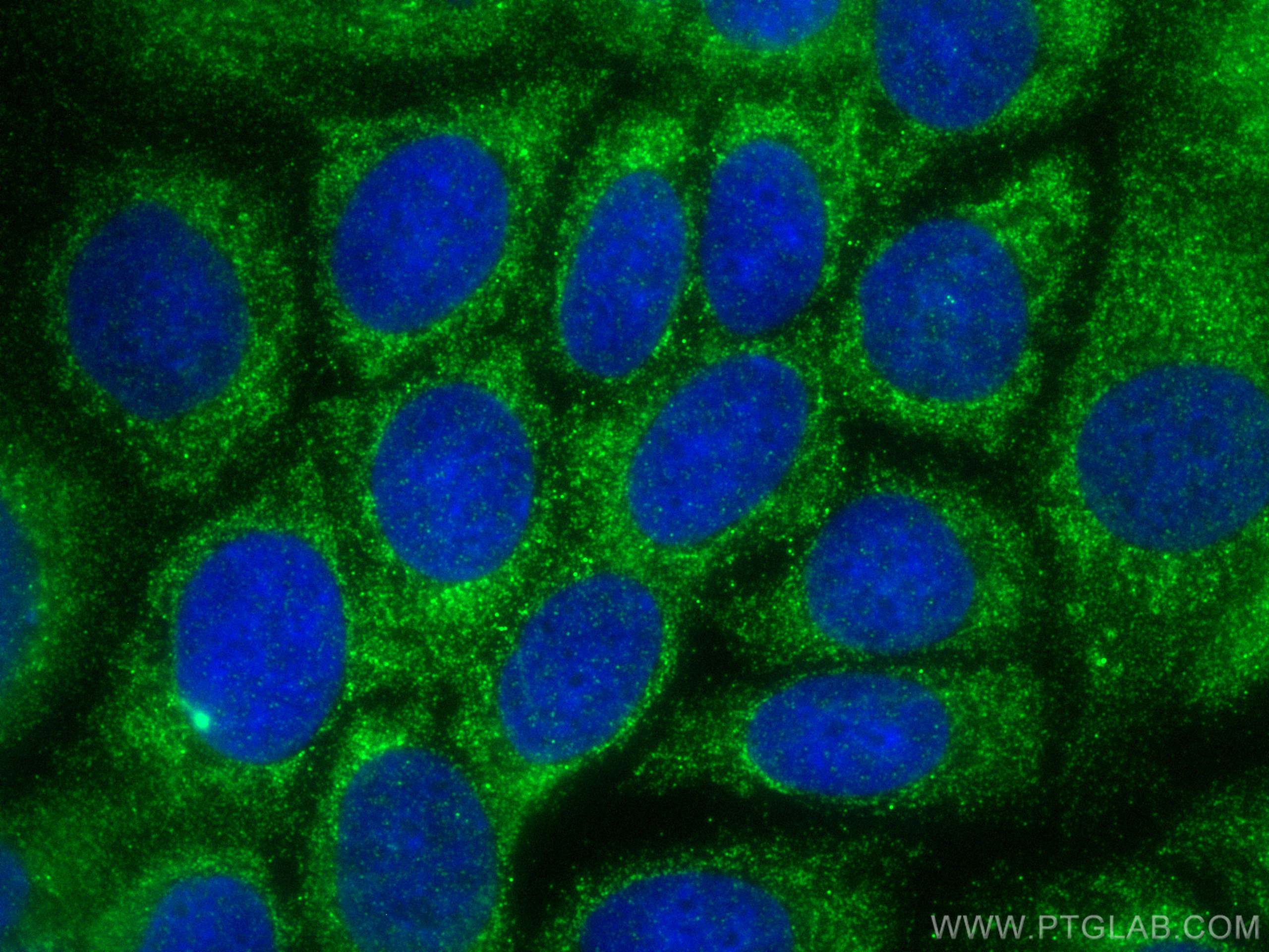 Immunofluorescence (IF) / fluorescent staining of MCF-7 cells using MMP13 Polyclonal antibody (18165-1-AP)