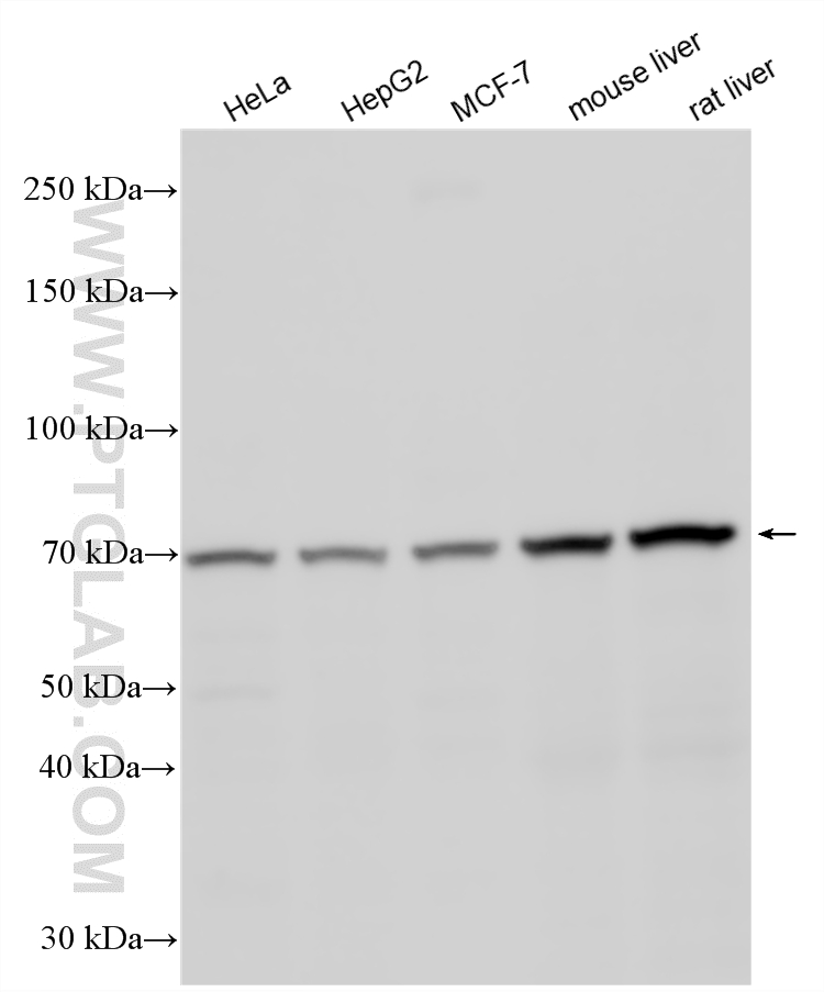 Western Blot (WB) analysis of various lysates using MMP13 Polyclonal antibody (18165-1-AP)