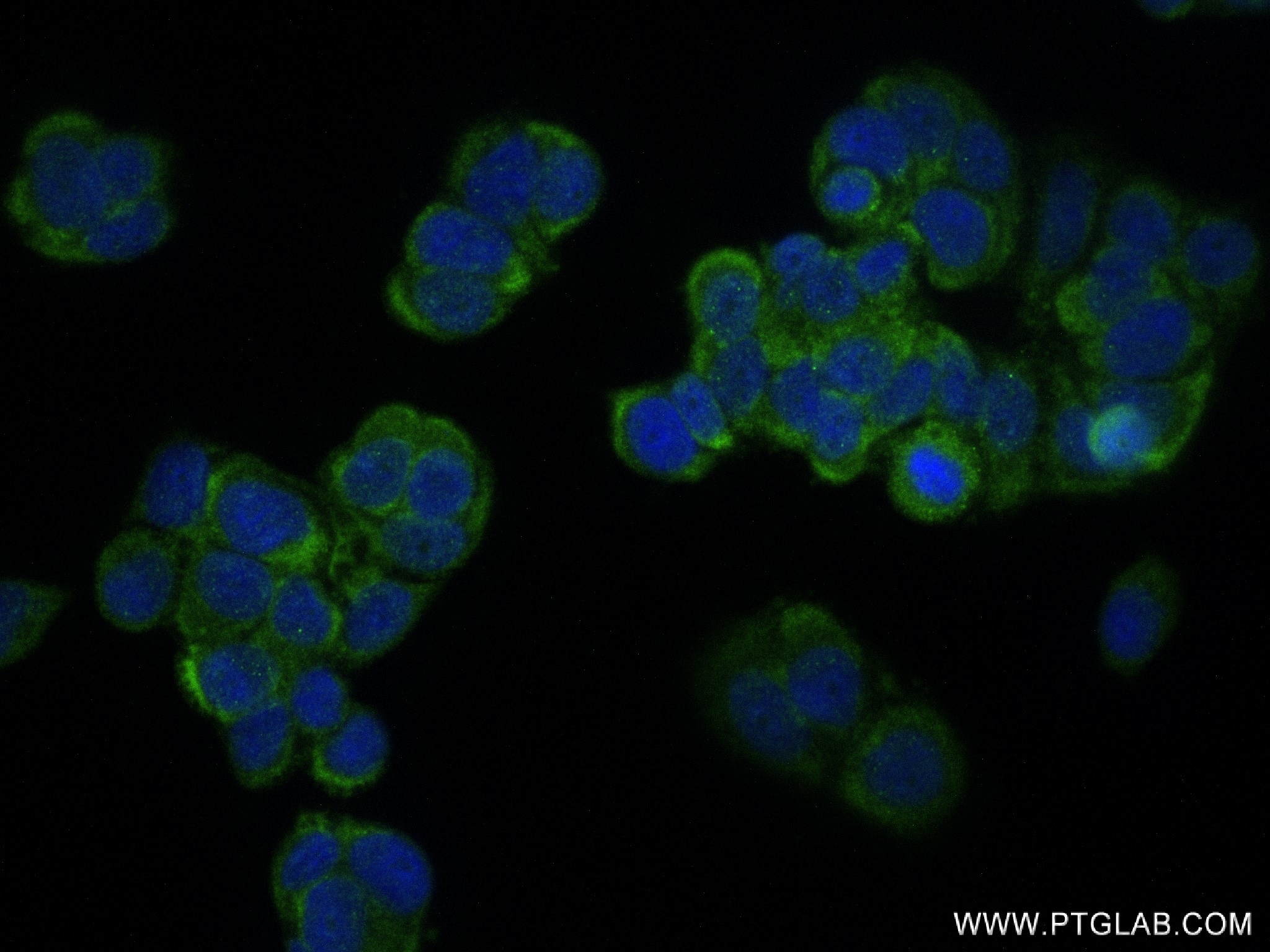 Immunofluorescence (IF) / fluorescent staining of MCF-7 cells using MMP13 Recombinant antibody (83188-2-RR)