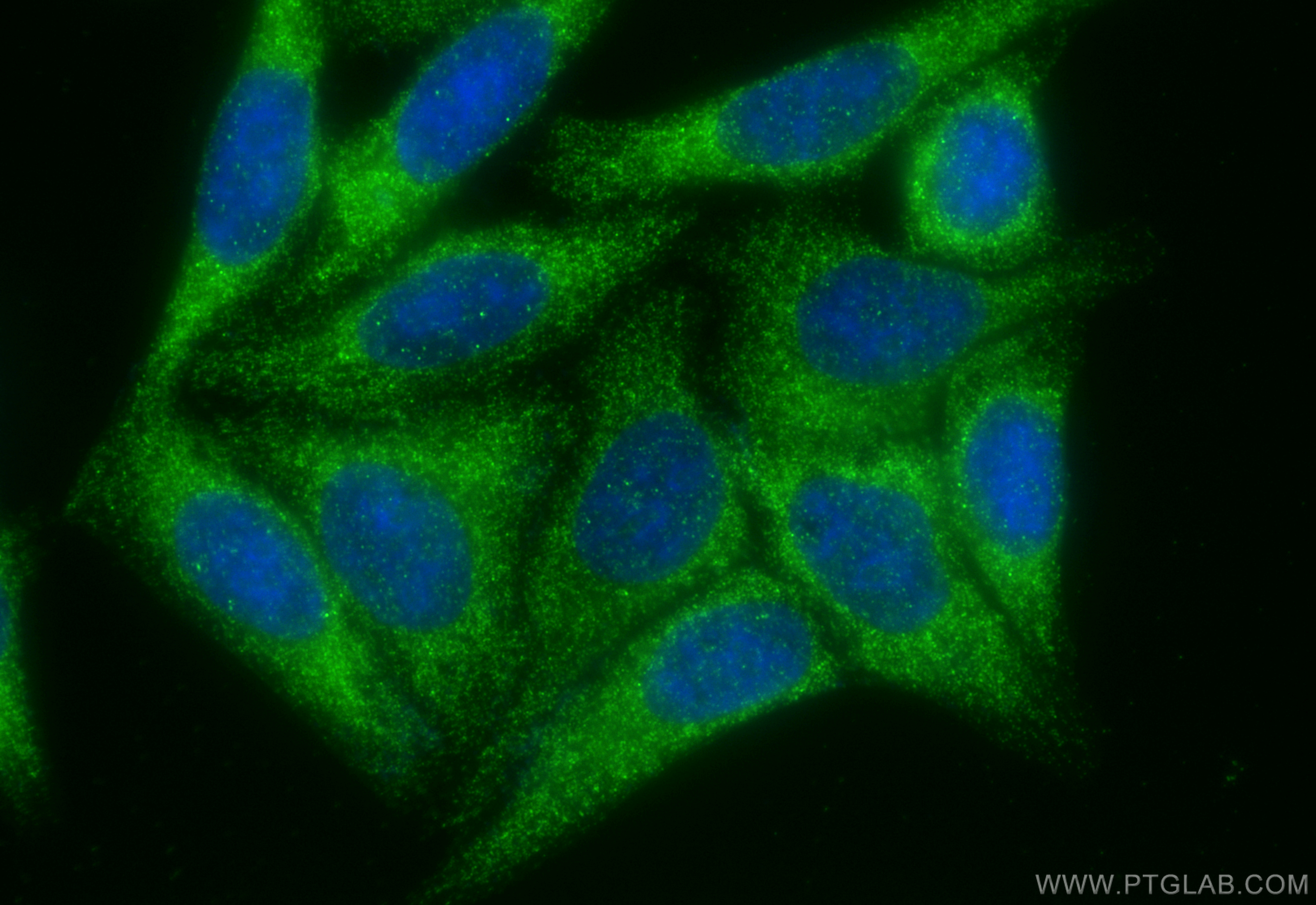 Immunofluorescence (IF) / fluorescent staining of HepG2 cells using MMP14 / MT1-MMP Polyclonal antibody (14552-1-AP)