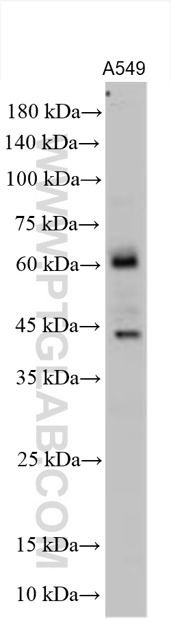 Western Blot (WB) analysis of various lysates using MMP14 / MT1-MMP Polyclonal antibody (14552-1-AP)