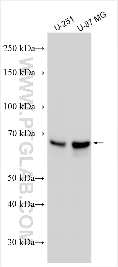 Western Blot (WB) analysis of various lysates using MMP2 Monoclonal antibody (66366-1-Ig)